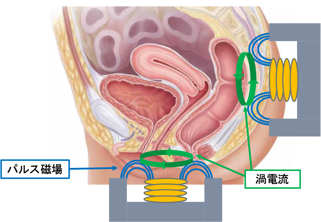 頻尿・尿失禁磁気刺激治療｢インティマウェーブ｣ | 佐井泌尿器科・皮フ科クリニック