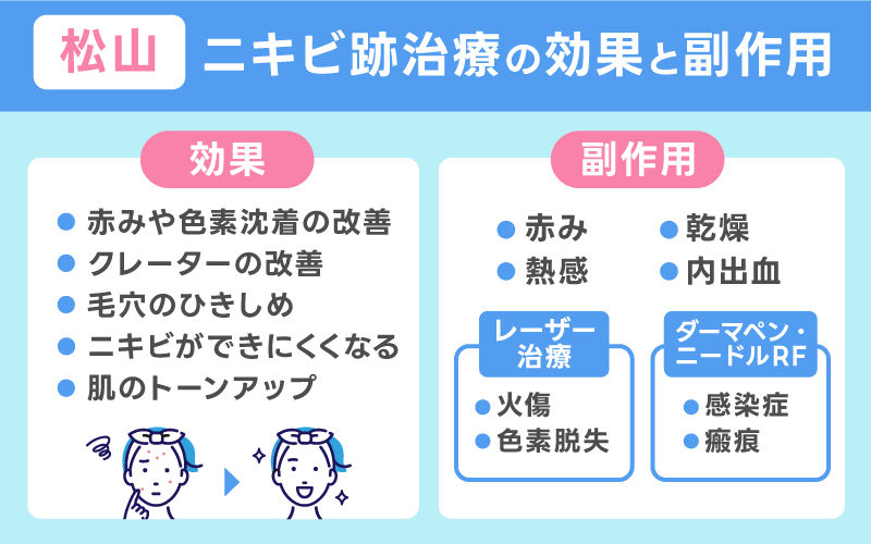 ニキビ跡治療　松山　効果と副作用