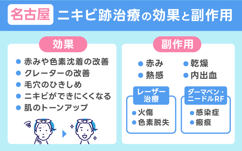ニキビ跡治療　名古屋　効果と副作用